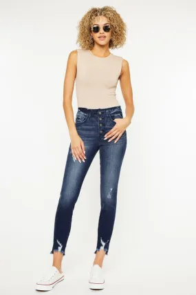 GEMMA HIGH RISE ANKLE SKINNY JEANS